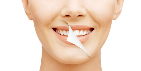 Shocking Revive Sky Lifestyle Teeth Whitening Review Before After Photos - h7qm0hd